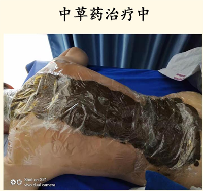 郜氏正骨传承人吴松功