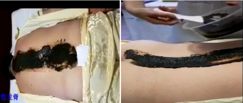 中国好医生——邢氏宝芝林经脉顺骨堂创始人  邢道国