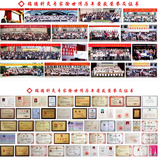 中医国粹针灸世家四代传人徐世传——专治偏瘫失语吊线风帕金森及杂症