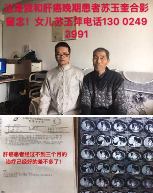 中医国粹中医皮肤科防治疑难杂病、癌症专家——林国和