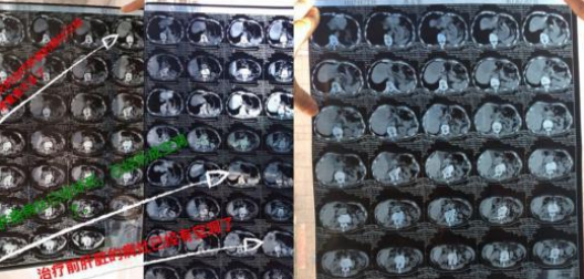 中医国粹中医皮肤科防治疑难杂病、癌症专家——林国和