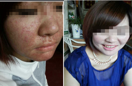 中医国粹人物——治疗急慢性肾小球肾炎、慢性肾功能衰竭等疾病 连正福医师