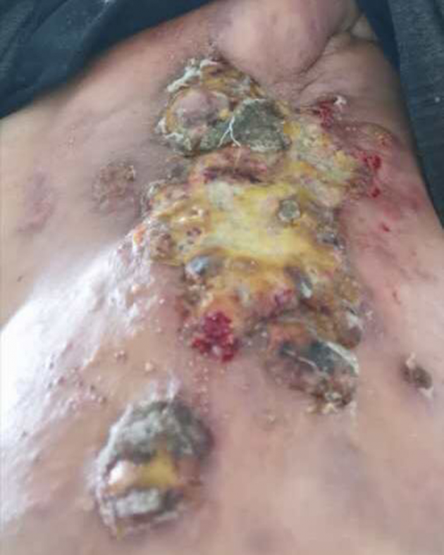 中医国粹人物专题报道---中医肿瘤专家周崇立七代祖传中医