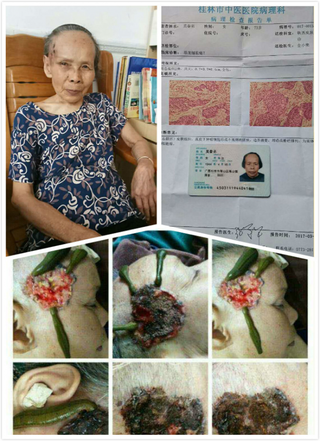 中医国粹人物专题报道---中医肿瘤专家周崇立七代祖传中医