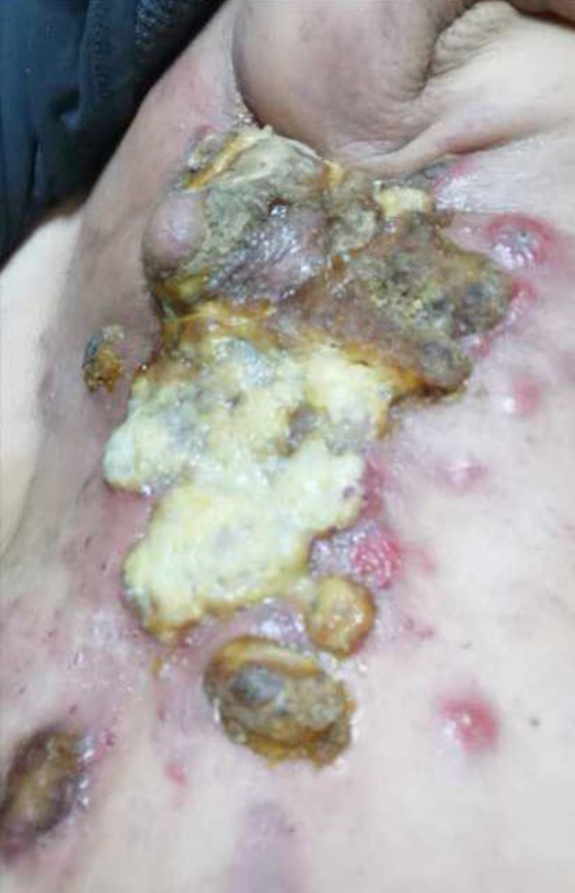 中医国粹人物专题报道---中医肿瘤专家周崇立七代祖传中医