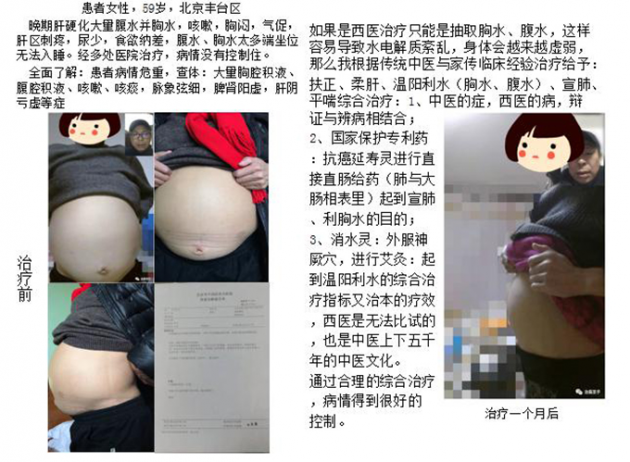 中医国粹人物专题报道---中医肿瘤专家周崇立七代祖传中医