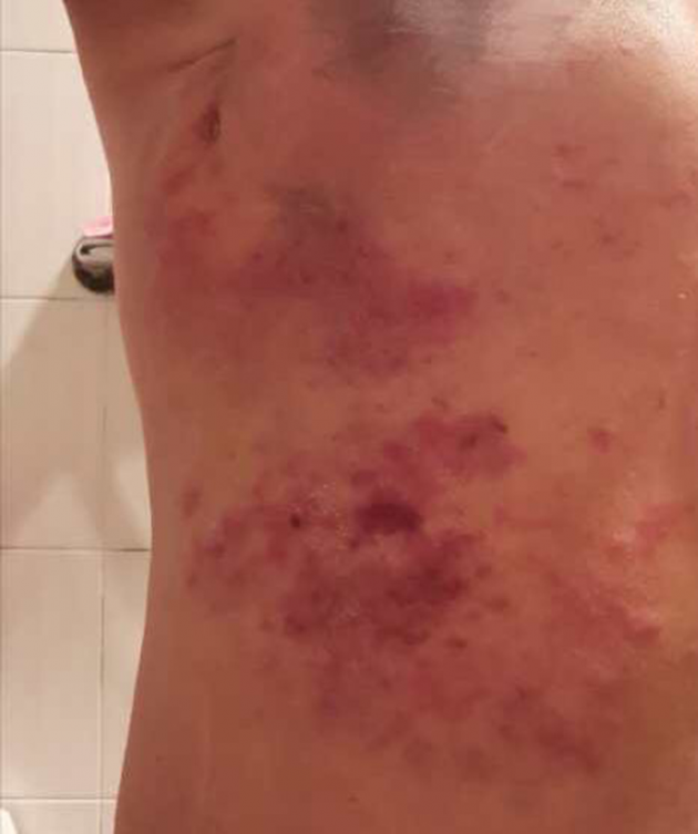 中医国粹人物专题报道---中医肿瘤专家周崇立七代祖传中医