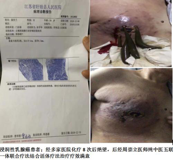 中医国粹人物专题报道---中医肿瘤专家周崇立七代祖传中医