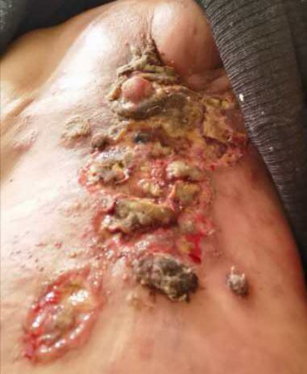 中医国粹人物专题报道---中医肿瘤专家周崇立七代祖传中医