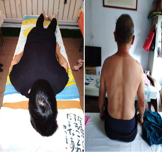 奇人奇术治疑难病——点对点手法技术李守仁老师