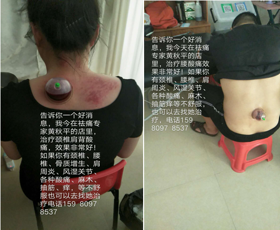 祛痛专家黄秋平——弘扬国粹施仁术 融汇古今铸医魂