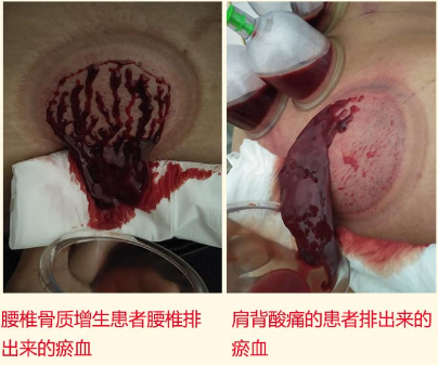 祛痛专家黄秋平——弘扬国粹施仁术 融汇古今铸医魂