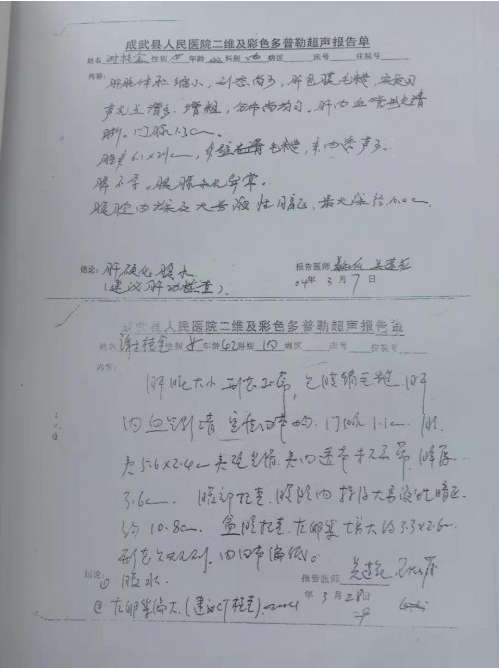 治疗肝硬化 肝腹水签订医患合同——专家邱延存