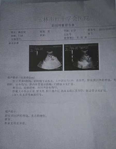 治疗肝硬化 肝腹水签订医患合同——专家邱延存