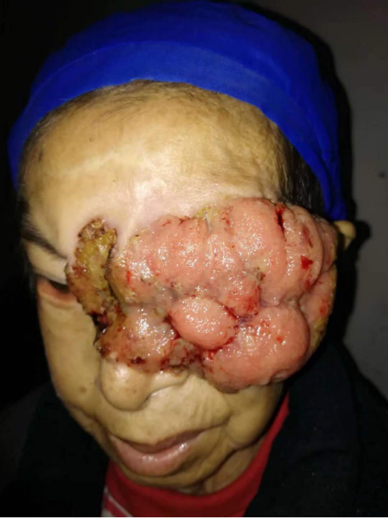 弘扬国粹施仁术 融汇古今铸医魂—钟贵红