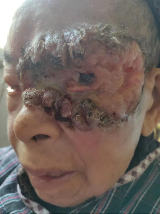 弘扬国粹施仁术 融汇古今铸医魂—钟贵红