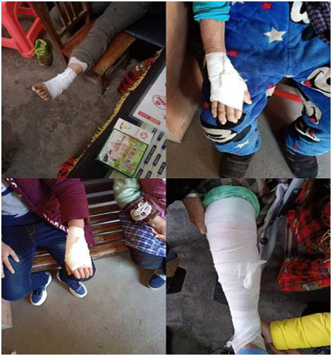 百年祖传治骨传人-阳衡清