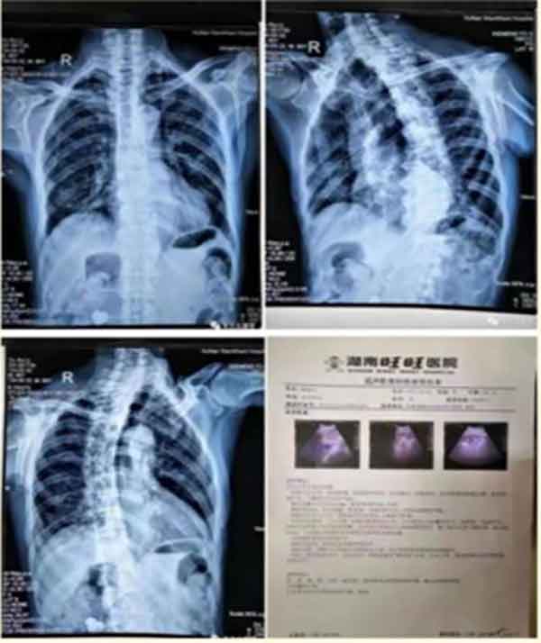 中医药传承人 —— 朱应龙