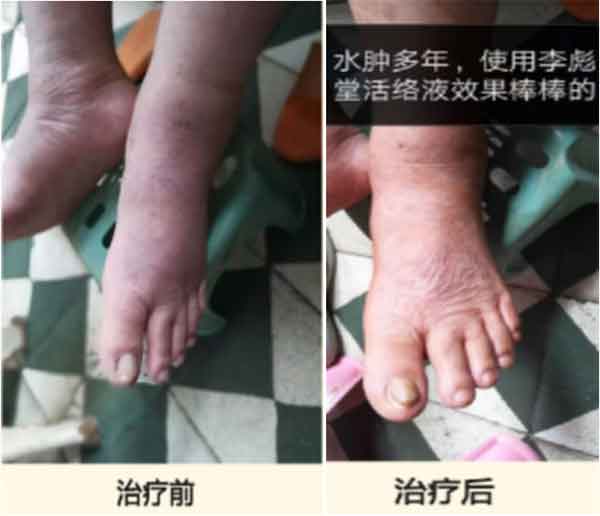 中国当代名医—李日彪中医