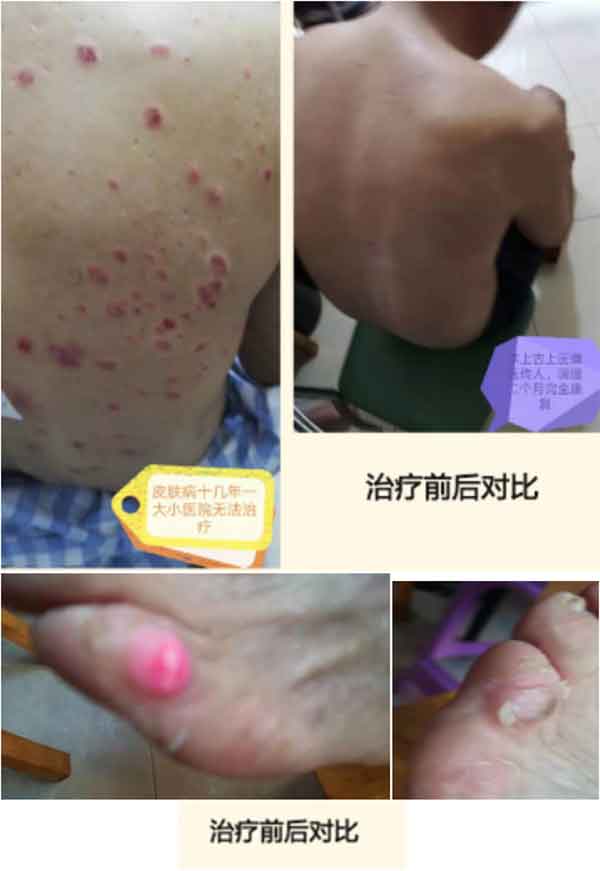 中国当代名医—李日彪中医