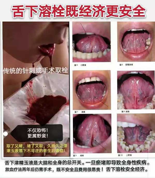 专访疑难病研究资深专家—唐启发