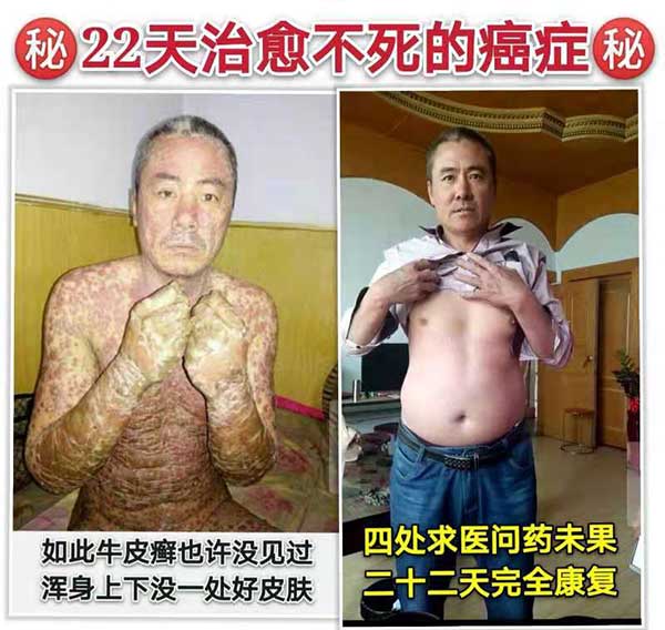 专访疑难病研究资深专家—唐启发