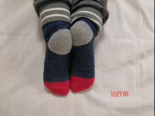 当代针刀医学传承人 — 孟德林