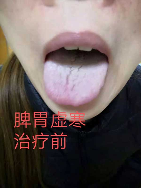 当代针刀医学传承人 — 孟德林