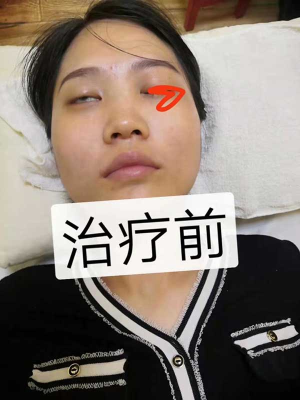 当代针刀医学传承人 — 孟德林