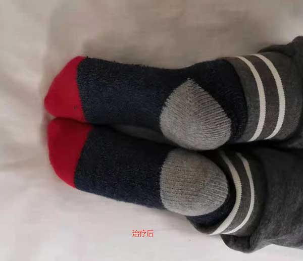 当代针刀医学传承人 — 孟德林