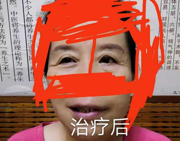 当代针刀医学传承人 — 孟德林