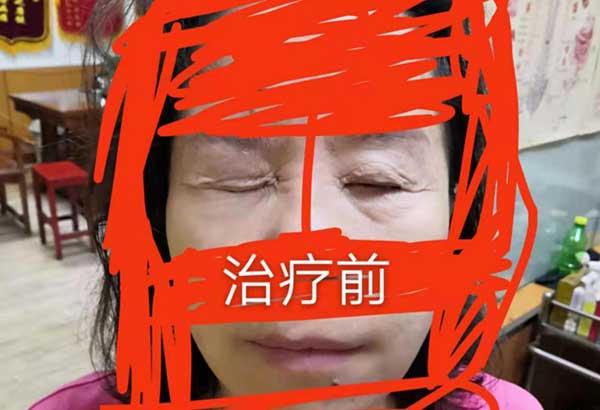 当代针刀医学传承人 — 孟德林