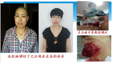 记当代中医骨膜消结术创始人——潘杏富