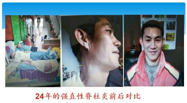 记当代中医骨膜消结术创始人——潘杏富