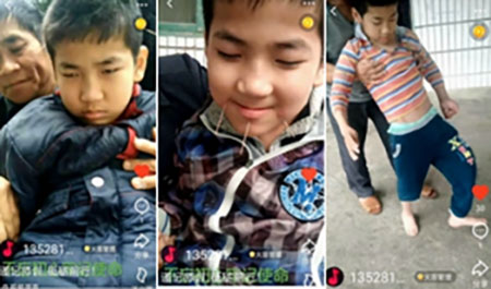 疑难病诊疗专家黎雪凤