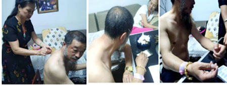 疑难病诊疗专家黎雪凤