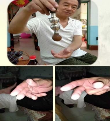 著名瑶医银疗推拿专家——周继辉