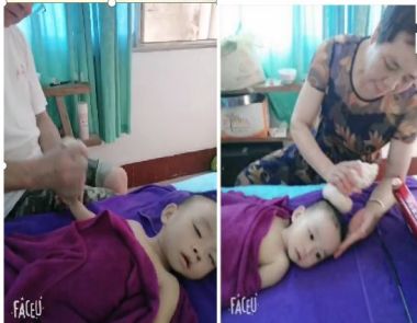 著名瑶医银疗推拿专家——周继辉