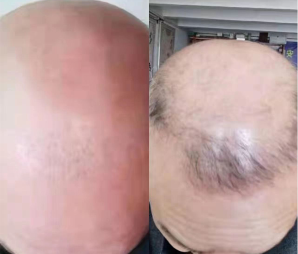 1657870385134854.png QQ图片20220715150751.png