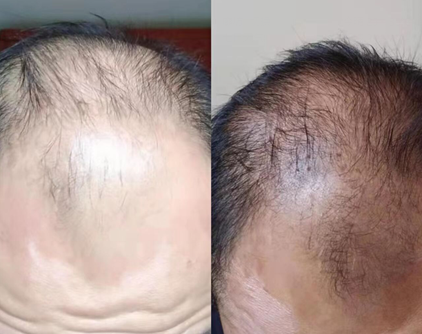 1657869909584011.png QQ图片20220715145929.png